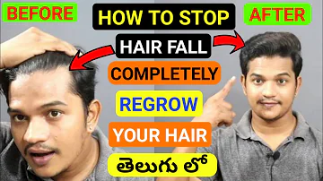 How To Control Hair Fall | REGROW Your Hair Fast Naturally | తెలుగు లో | హెయిర్ గ్రోత్ చేసుకోండి