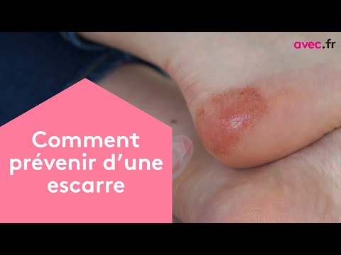 Comment prévenir une escarre ? Formation ADVF