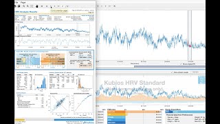 Analyzing Polar session HR data in Kubios 3.4 Free Edition screenshot 5