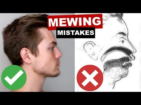 What Is Mewing and How Does it Work?