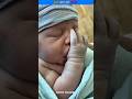 Why Thumb Sucking is Bad for Kids?#shorts #important