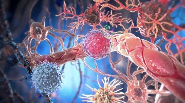 Pathophysiology of MS