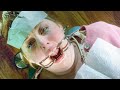 The Dentist S Victim Full Movie English Subtitles 