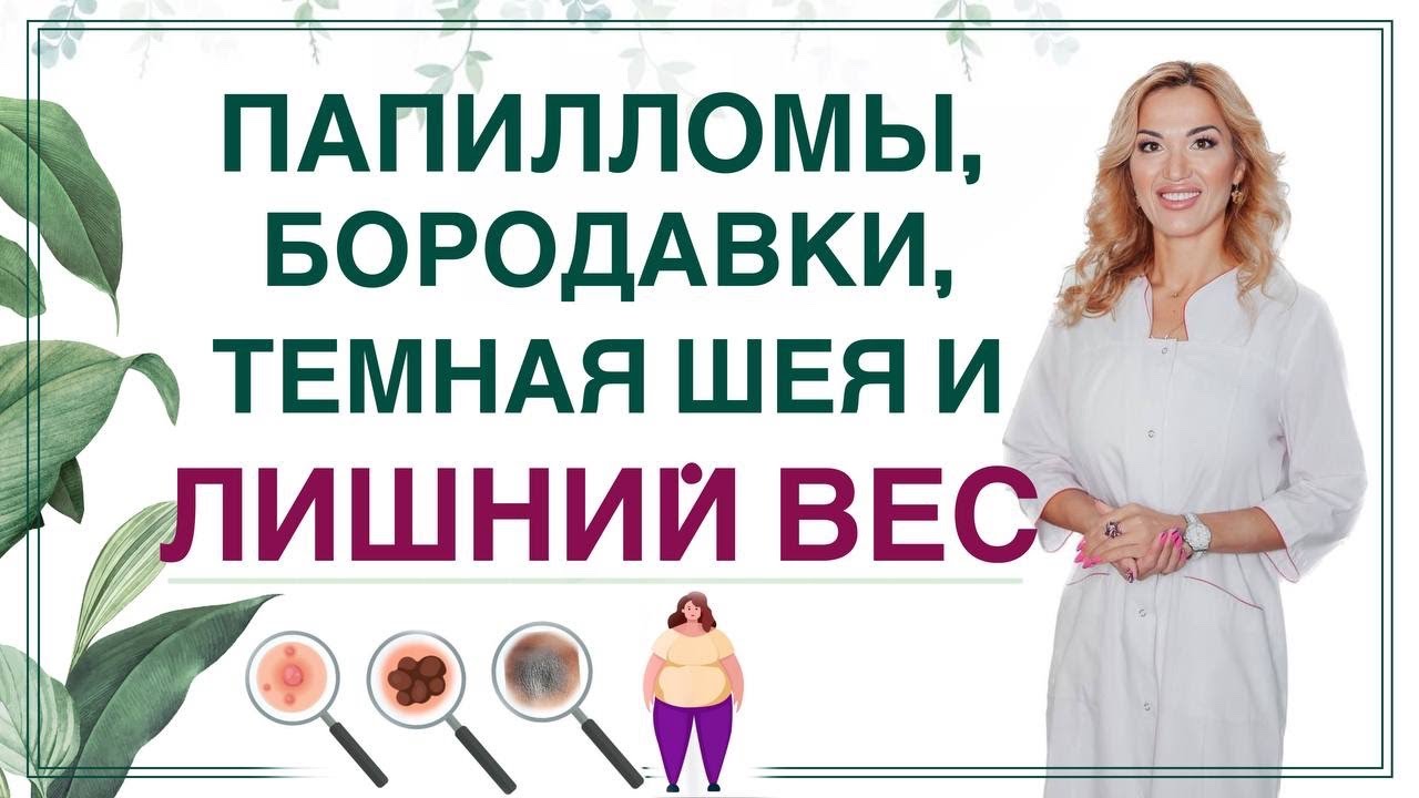 ❤️ ОЖИРЕНИЕ, ИНСУЛИН И ПАПИЛЛОМЫ, БОРОДАВКИ, ТЕМНАЯ ШЕЯ. Врач эндокринолог диетолог Ольга Павлова.