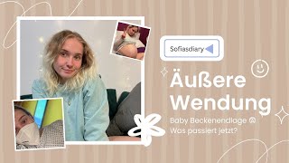 Mein Baby lag in Beckenendlage | Äußere Wendung | Erfahrungsbericht screenshot 4