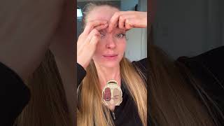 Smooth Forehead without Botox