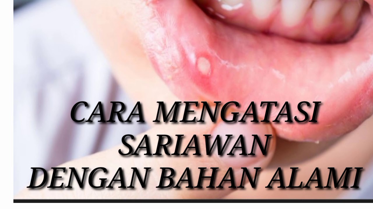 CARA ALAMI MENGATASI SARIAWAN 