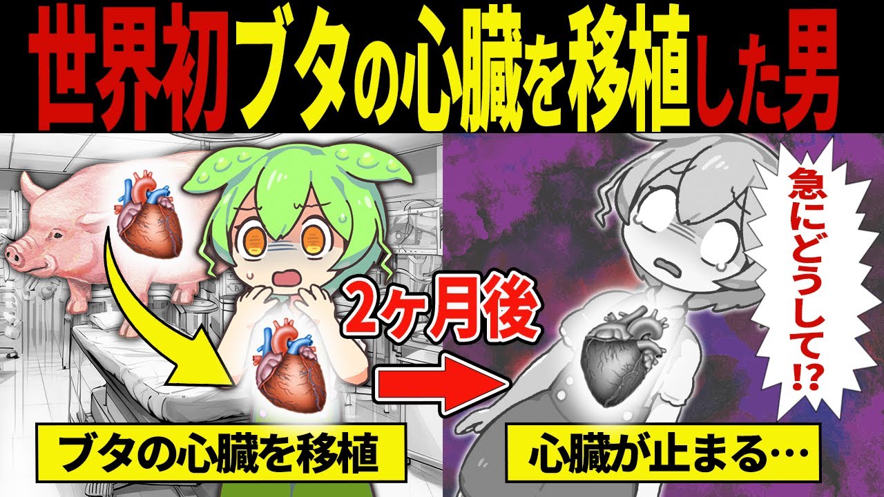 【実話】ブタの心臓を移植されたずんだもんの末路【ずんだもん＆ゆっくり解説】