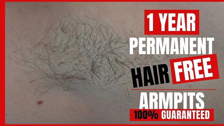 Electrolysis Hair Removal: Armpits (1year)