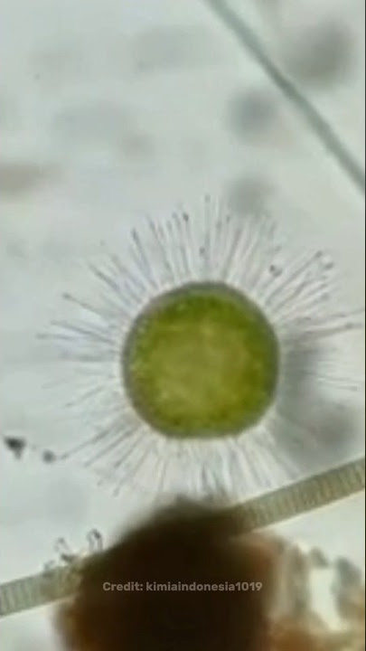 Covid under the microscope😳| #shorts