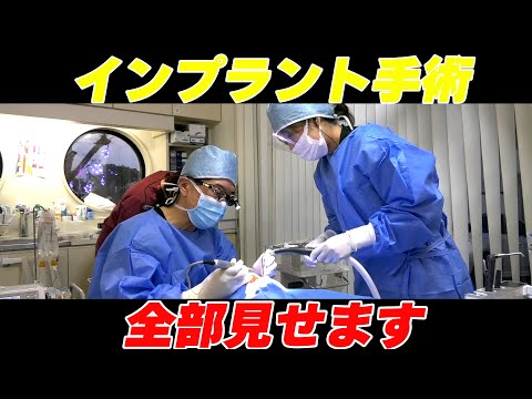 インプラント手術 全部見せます