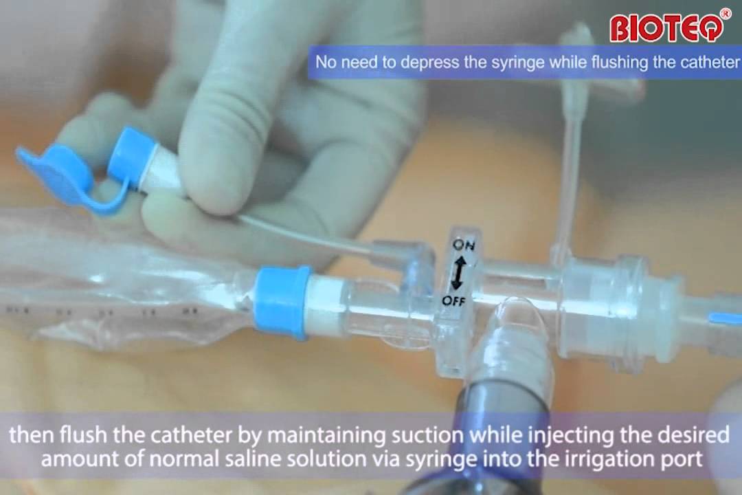How To Flush A Catheter With Saline (2023)