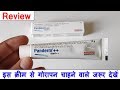 Panderm ++ Cream Review in Hindi | गोरा बनाने वाली क्रीम का सच