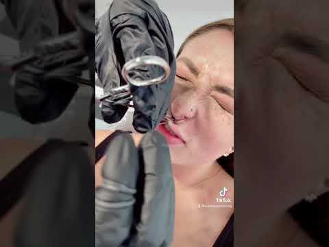 Video: Een Medusa-piercing krijgen (met afbeeldingen)