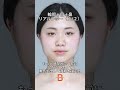 ビフォーアフター┃輪郭＋鼻＋目┃平凡なイメージから可愛くて綺麗、垢抜けたイメージに💎┃ブラウン整形外科┃#韓国 #渡韓 #美容 #美容整形 #垢抜け #小顔 #小顔整形 #小顔カット #可愛い
