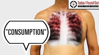 Why Was Tuberculosis Called Consumption?