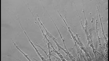 Human neural tissue migration video