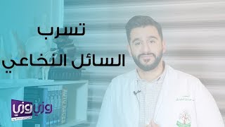 تسرب السائل النخاعي