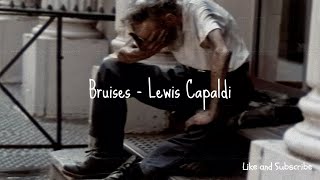 Lewis Capaldi - Bruises