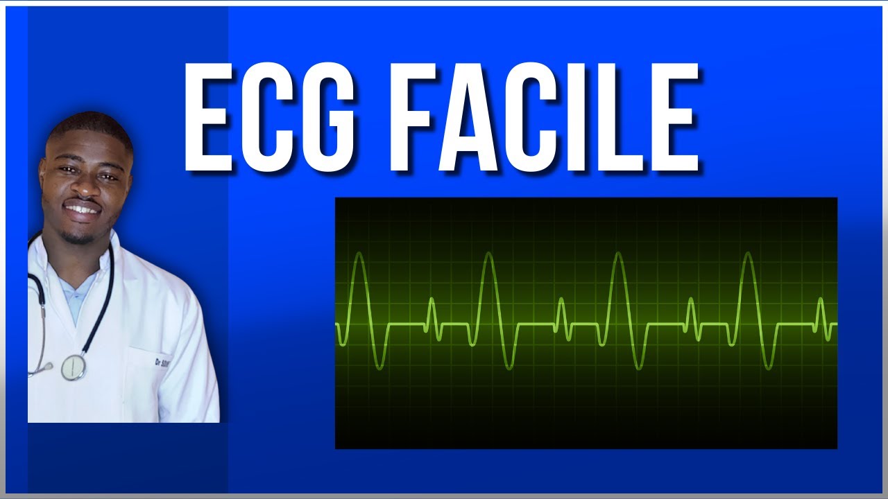 ECG facile : comment interpréter n’importe quel tracé (méthode USMLE Step 1)