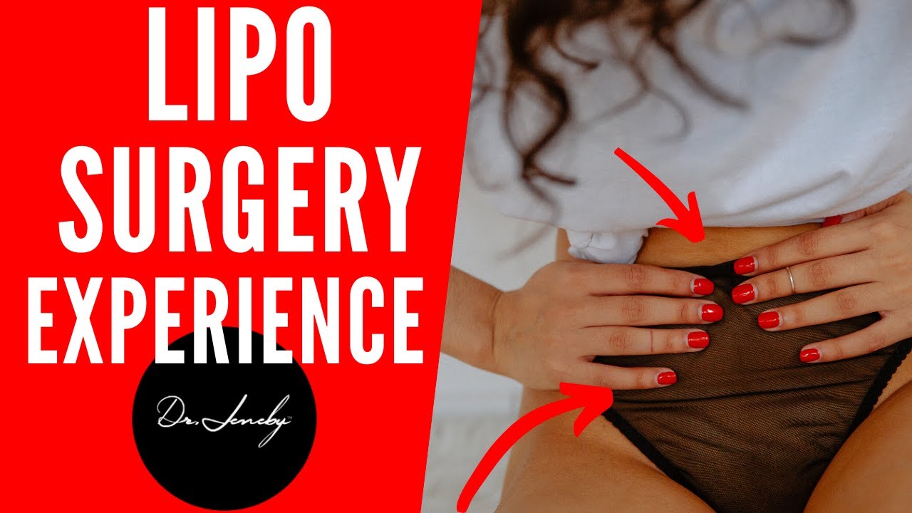 Liposuction Experience LIVE FROM THE OR Liposuction 5 Areas San