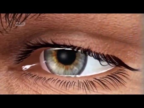 ვიდეო: როგორ დაბრმავება თვალები