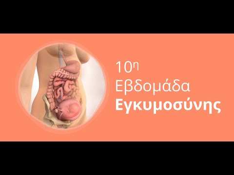 Βίντεο: Πώς είναι η 10η εβδομάδα της εγκυμοσύνης