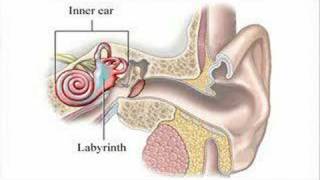 Meniere&#39;s disease