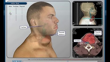Interactive Slice Chooser: 3-D Animations for MRI or CT Scans