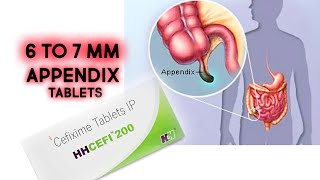 appendix tablet cifixime 200 | 6 to 7 mm appendix symtoms | अपेंडिक्स की सूजन की दवा |abdominal pain