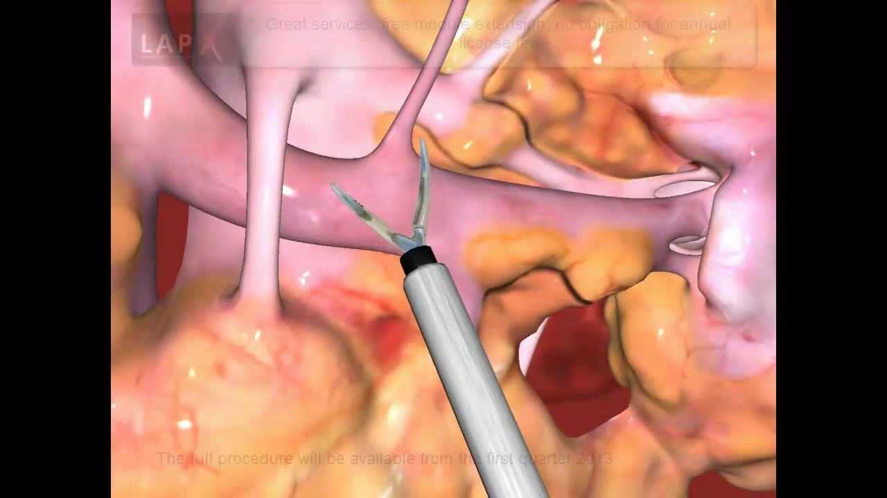 Lap X Laparoscopic Simulator For Minimally Invasive Surgery Youtube