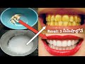 Teeth Whitening At Home in 3 Minutes | How to whiten Your Yellow Teeth Naturally |