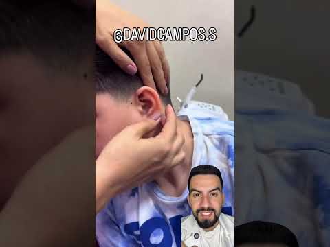 PRÓTESIS DE OREJA