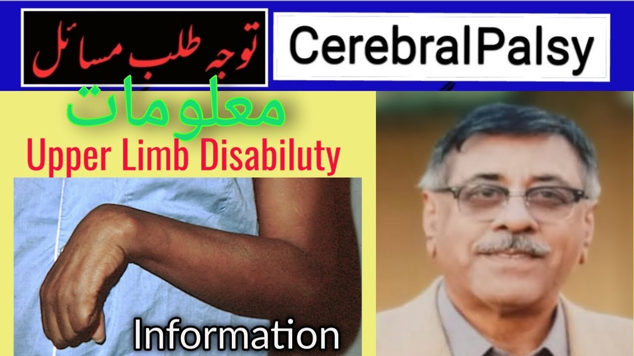 Spastic Cerebral Palsy with Upper Limb Issues/ Complete Management ...