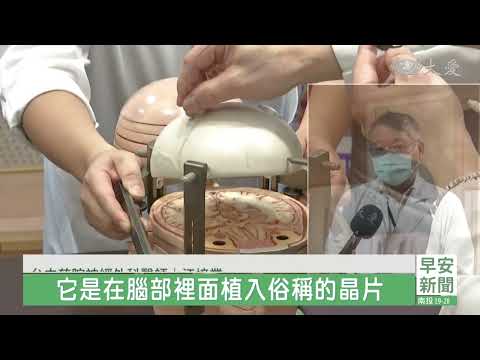 腦部手術.持續運動 延緩巴金森氏症退化