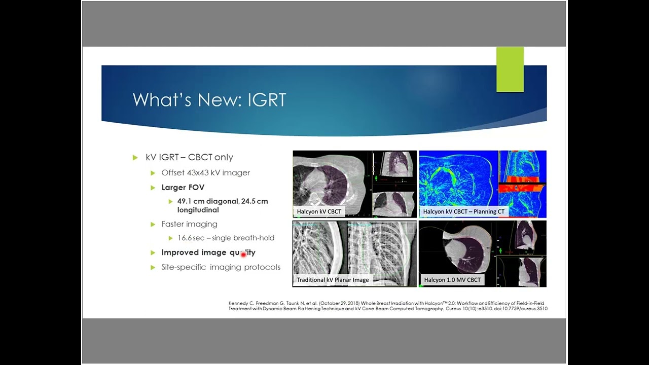 Breast Treatment Halcyon Varian