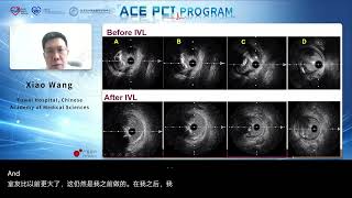 ACE PCT, PROGRAM - Organized by AHS Interventional Cardiology Council