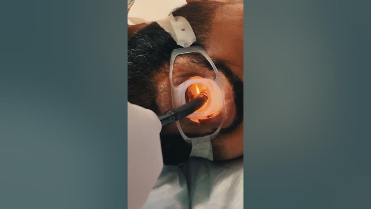 Gastroscopy تنظير المعدة YouTube