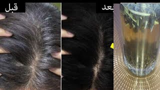 اقوى وصفة طبيعية  لعلاج تساقط الشعر بمكون لايخطر على البال ستكثف وتطور شعرك من اول الاستعمال