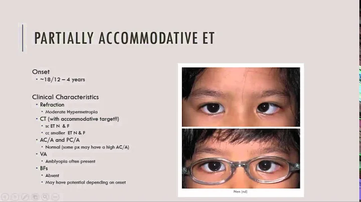 Partially Accommodative ET Characteristics