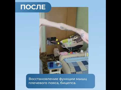 Плечевое нервное сплетение.