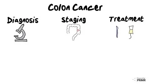 New Colon Cancer Diagnosis - What to Expect