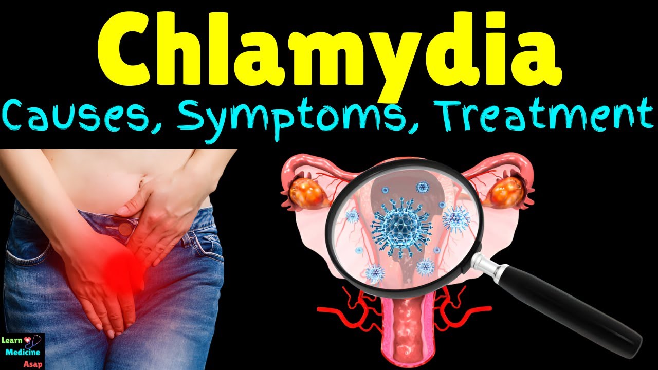 Chlamydia Causes Symptoms Diagnosis Treatment Complications 