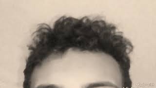 Tamanho Da Testa De Vitor