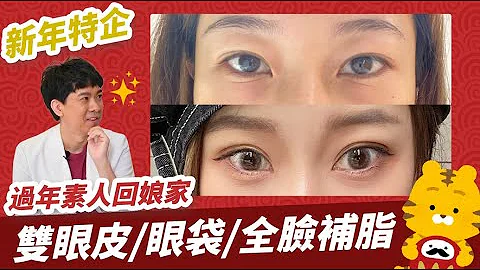 新年特企｜全脸复合手术半年恢复状况！案例素人Liz回娘家｜全脸手术夯在哪？！【晶华医美诊所】陈玮农医师｜晶华美力GOOD｜桃园双眼皮推荐 桃园眼袋推荐 桃园全脸补脂推荐 - 天天要闻