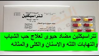 تتراسيكلين مضاد حيوى قوى لعلاج حب الشباب والتهابات اللثه والاسنان والكلى والمثانه