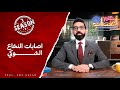 إصابات العمود الفقري و النخاع الشوكي أ د عمرو حسن الحسني حكيم أعصاب موسم ٣ح١١ 