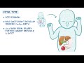 Biliary atresia