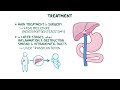 Biliary atresia