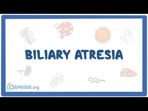 Biliary Atresia: Why Babies Develop Jaundice and Acholic Stools